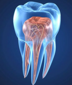 Dantų kanalų gydymas